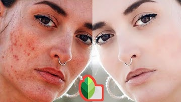 How To Remove Pimple And Face Smooth In Snapseed ||