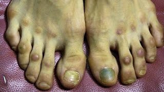 Why You Have Ugly Feet