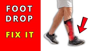 Foot Drop recovery without surgery