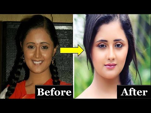 Top 10 Indian TV actresses with plastic surgery - The TopLists