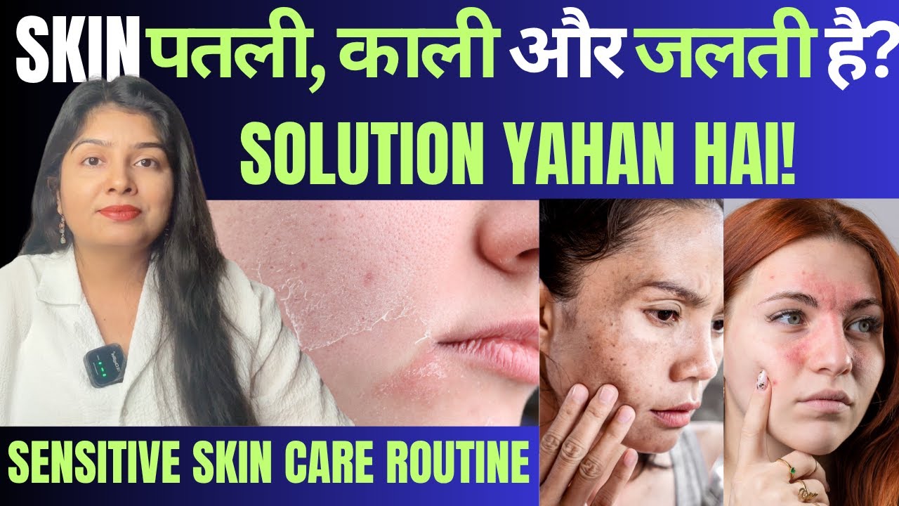 Steroid se Bigdi Skin? Pigmentation + Sensitivity Ka Full Solution |Sensitive Skin Care Routine