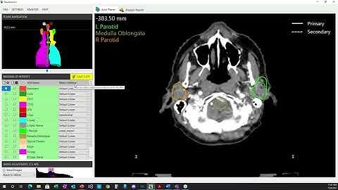 Intelligent AI Autosegmentation QA