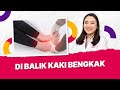 Penyebab dan pengobatan kaki bengkak