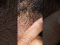 ASMR  #massage therapy #satisfying #beard #skincare #haircare #ingrownhair #shorts #video