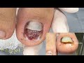 😱 VEJA O QUE PODE ACONTECER SE UMA PEDRA DE ALICERCE CAIR EM SUA UNHA #satisfying #usa