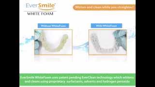 Eversmile Whitefoam Cleans Candid Co., Smile Direct Club, And Invisalign And Retainers On-The-Go