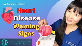 3 WARNING Signs of Heart Disease | Clues in Your Eyes | Eye Surgeon Explains