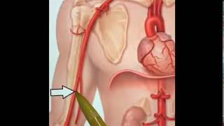 How to Palpate the Brachial Pulse