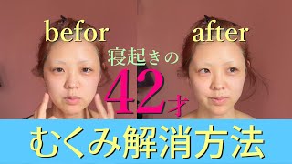 寝起きの【むくみ解消】にも効果抜群な美顔器【バイタリフトかっさの使い方】