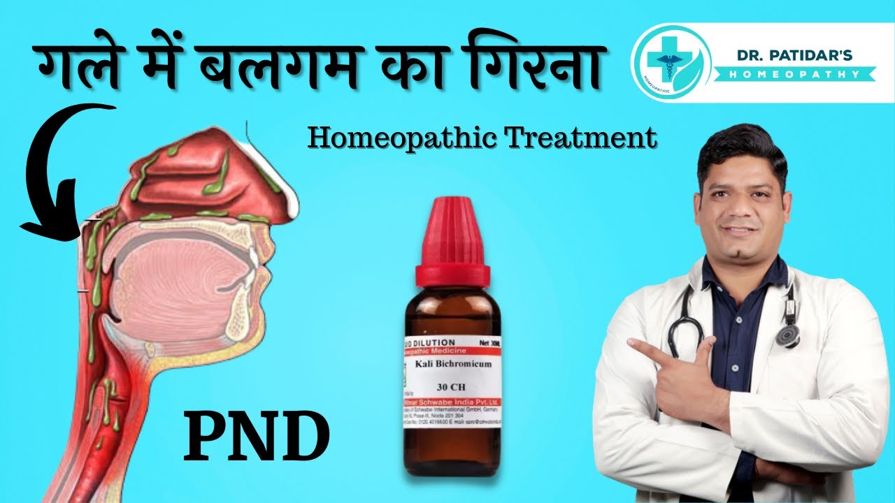 PostNasal Drip Homeopathic Treatment गले में बलगम का गिरना Causes