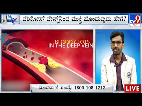 Nimma Doctor | Treatment For Varicose Veins | Homeocare International (01-08-2023) #TV9A