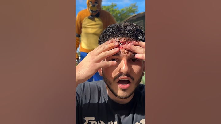 HE STAPLED MY HEAD !! #freddyfazbear #heynelm #scary #fnaf