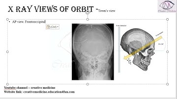Lec 2 X ray Views of Orbit  Town’s view mp4 || OPHTHALMOLOGY