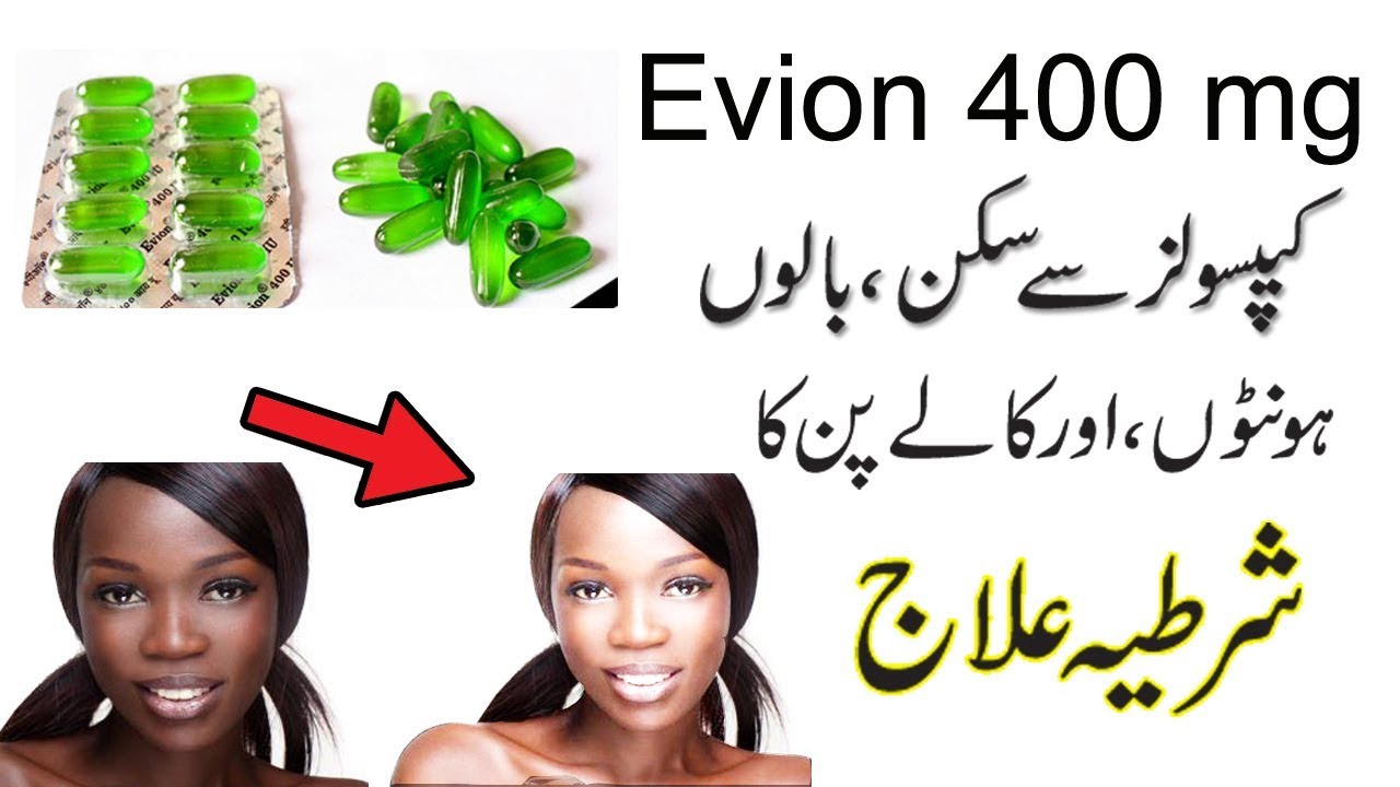 Evion 400 Vitamin E Capsule For Skin Whitening And Hair Growth - Benefits  For Female - YouTube