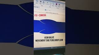 Famous Popliteal vein valve (venous valve) movement due to blood flow | Comsol simulation Wealth