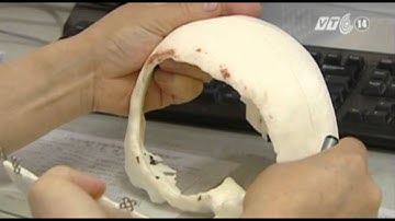 VTC14_Trung Quốc: Công nghệ in 3D phát huy tác dụng trong lĩnh vực y tế