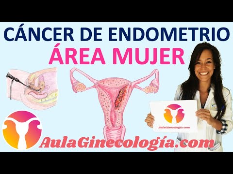 ¿La Endometriosis Se Conoce Como Cáncer De La Mujer De Carrera?
