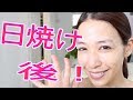 【美容】【肌ケア】日焼け後のケアはとっても大事！浴びた紫外線を相殺する方法とは？