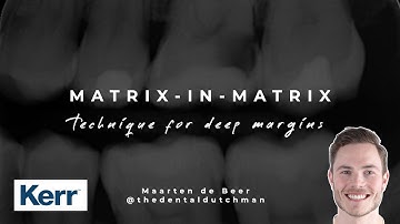 Deep Margin Elevation Made Simple | Matrix-in-Matrix Technique Tutorial