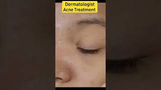 Dermatologist | Acne Treatment #youtube #youtubeshorts #youtubeshort
