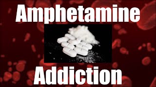 Amphetamine Addiction - It Will Change Your Soul! | South Coast Counseling