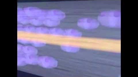 Mercury and Your Brain - Shocking Video!!