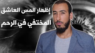 رقية المس المختفي في الرحم يتسبب في الام الرحم وفك عقد الأرحام واضهار المس المختفي