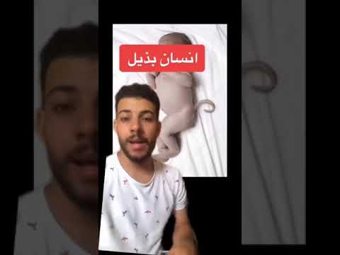 انسان لديه ذيل