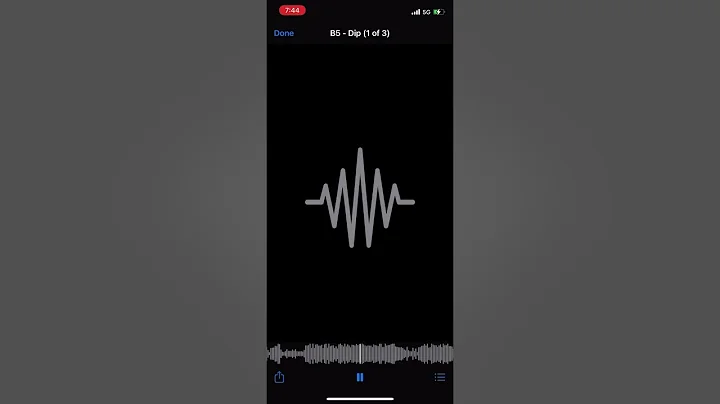 Rx B5 - Dip (snippet)