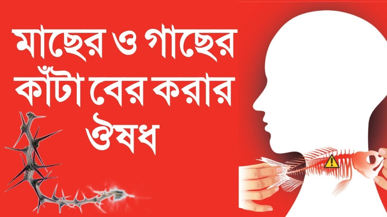 শরীরে গাছের আর গলায় মাছের কাটা বিঁধলে কি হোমিওপ্যাথি ঔষধ খাবেন | Remove fish bone & thorn