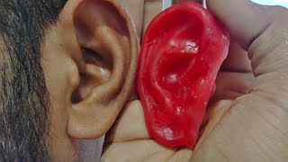 Wax Sculpting For Artificial Ear Prosthesis Inspire Health Care Dr. Hiren Babariya