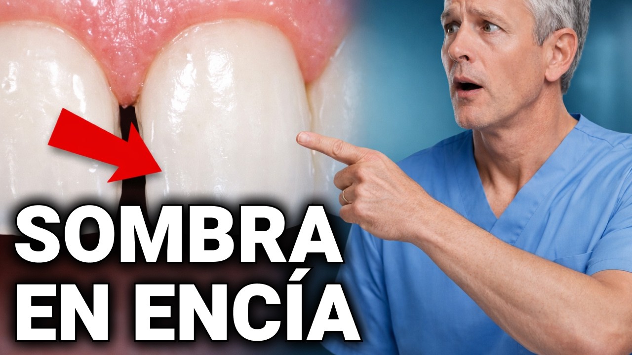 Dientes perfectos y ahora esto… cerca de la encía