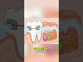 Braces Are Not What You Think: Biology's Brutal Tooth Movement #shorts