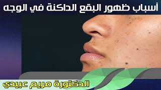 أسباب ظهور البقع الداكنة في الوجه متى تكون خطيرة الدكتورة مريم عبيدي
