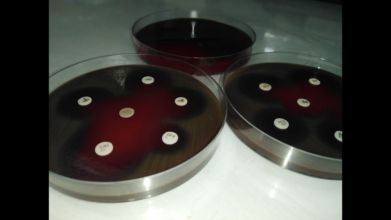 Tout sur les milieux de culture en bactériologie médicale