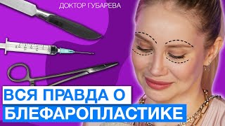 ВСЯ ПРАВДА О БЛЕФАРОПЛАСТИКЕ: как проходит, какие противопоказания, зачем делать?