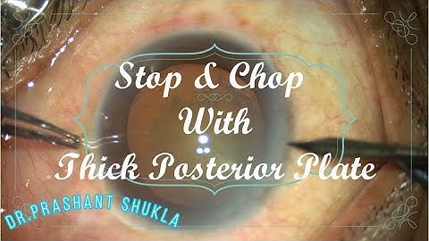 STOP AND CHOP WITH THICK POSTERIOR PLATE