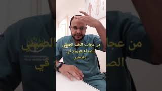 من عجائب الطب الصيني الصداع هيروح في دقيقتين