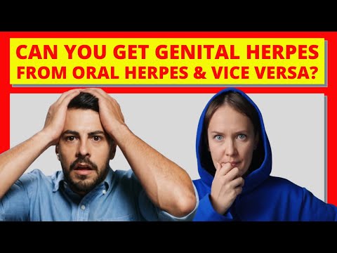 Možete li dobiti genitalni herpes od oralnog herpesa i obrnuto?