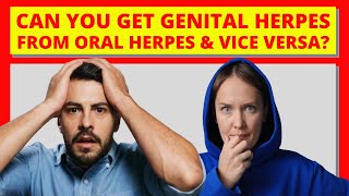 Can You Get Genital Herpes From Oral Herpes And Vice Versa?