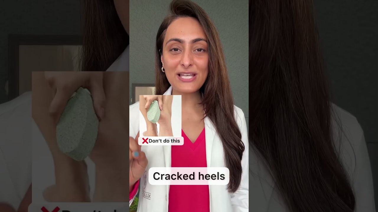 Cracked Heels How To Manage Dermatologist Suggests