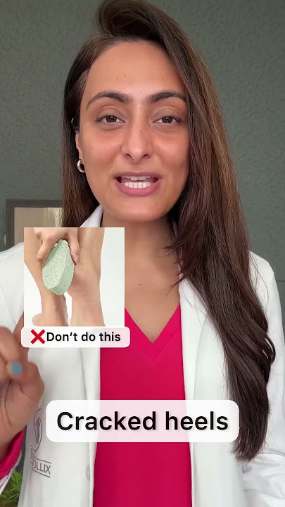 Cracked heels| How to manage | Dermatologist suggests