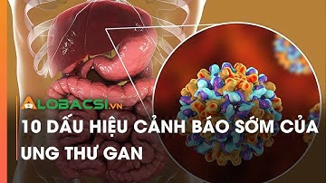 10 dấu hiệu cảnh báo sớm của ung thư gan