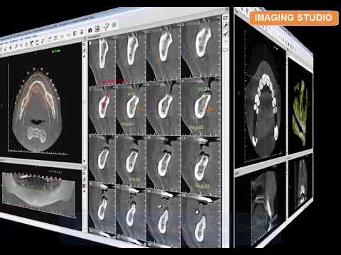 Softwares para Laudo a Distância - Radiologia Odontológica - Anne Solutions