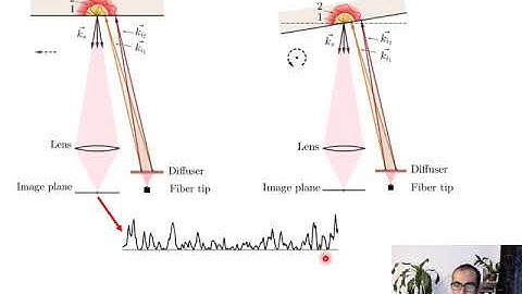 Exploration of movement artefacts in handheld laser speckle contrast perfusion imaging