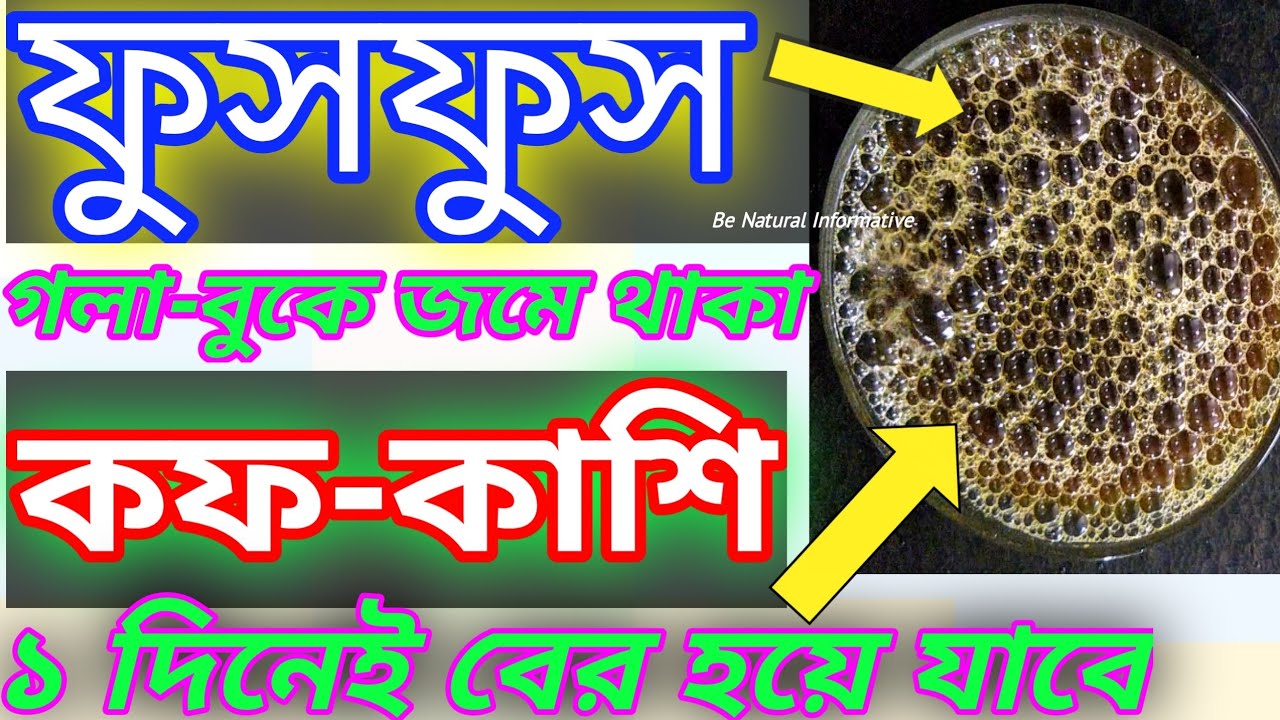 শুধুমাত্র ৫ মিনিটে সর্দি,কাশি,কফ থেকে মুক্তি।home remedies for cough