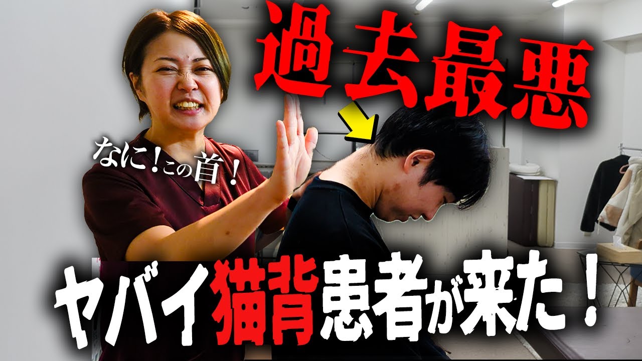 「こんな首…見たことない」２４歳の重症猫背患者の首が固すぎて…これ以上どうしようもありませんでした