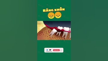 [3D] RĂNG KHÔN | Nha Khoa Quốc Tế Athena