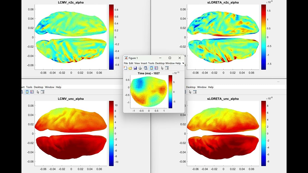 Alpha activity from sLORETA & LCMV. Brain activity reconstruction from MEG.