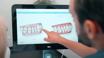 Dentist reviews the iTero Element™ 5D Plus scanner for restorative and orthodontic treatment
